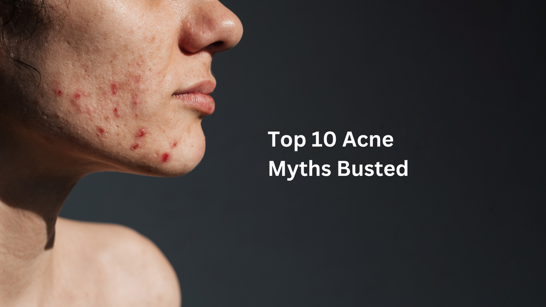 Exploring effective acne treatment options and skincare tips