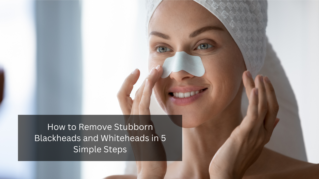 Remove blackheads & whiteheads effortlessly for clear, smooth skin